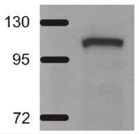 ADH/ALDH | Alcohol/acetaldehyde dehydrogenase (bacterial/algal) in the group Antibodies Plant/Algal / Environmental Stress / Hypoxia at Agrisera AB (Antibodies for research) (AS10 748)
